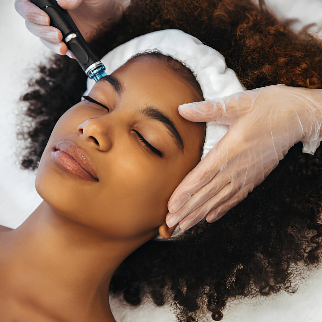 Micro-Infusion Treatment - Image 2